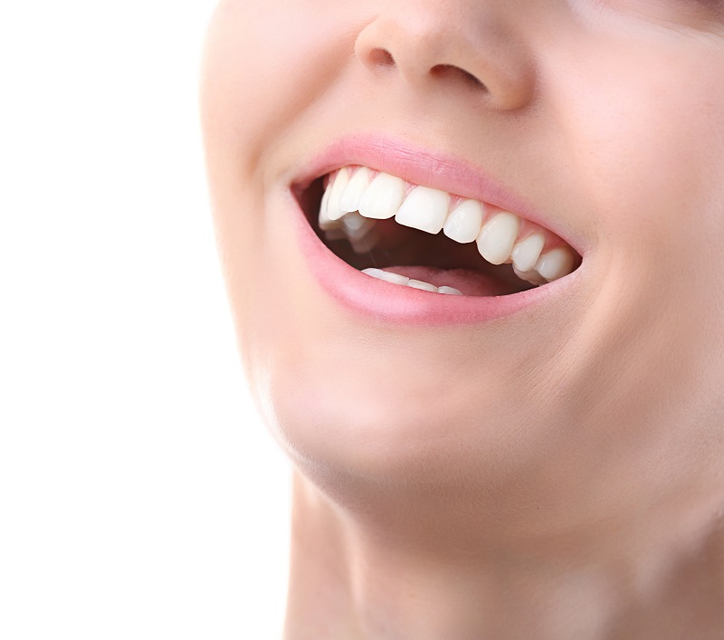 Teeth whitening 22304